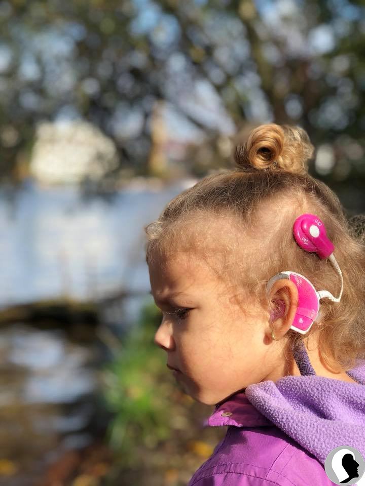 CI Kopf 2018 weiblich Kind